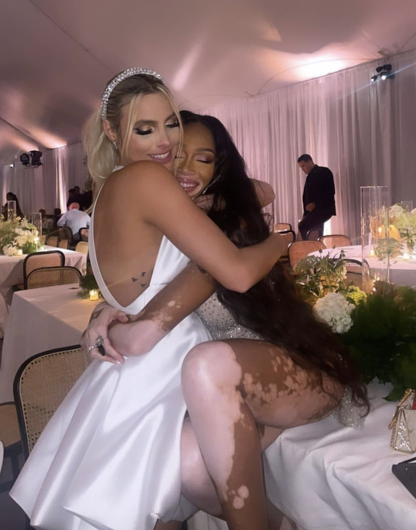 Lele Pons e a modelo Winnie Harlow 